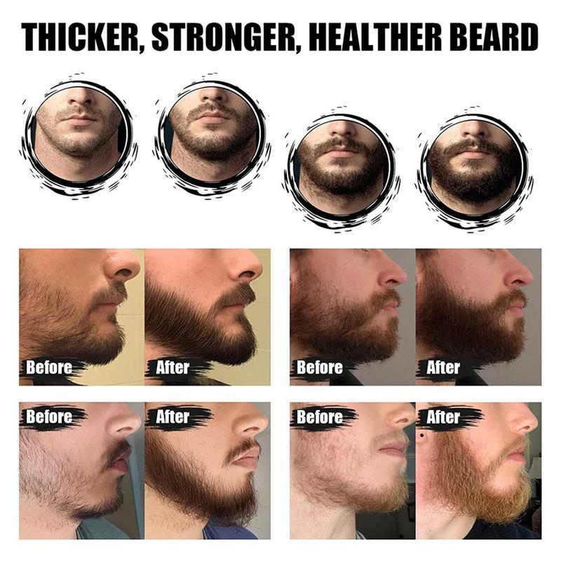 5pcs Men Beard Barba Grooming  - Men'S Grooming Tonic 评论和价格